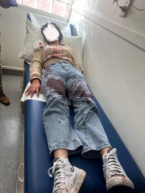 The 12-year-old girl was left covered in blood after being assaulted outside McDonald's Glenfield...