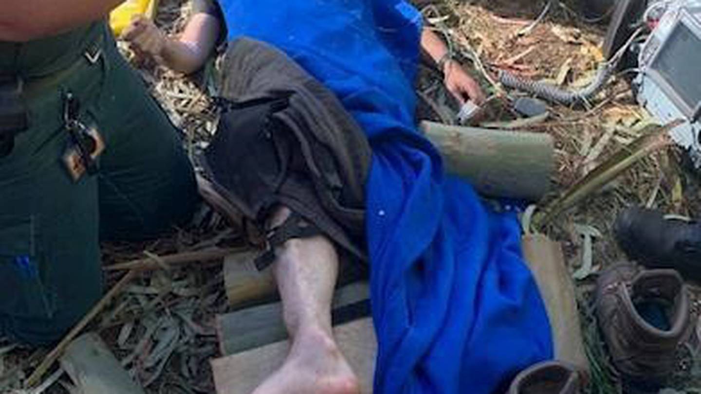 Zion Pilgrim injured himself while cutting wood. Photo: Supplied