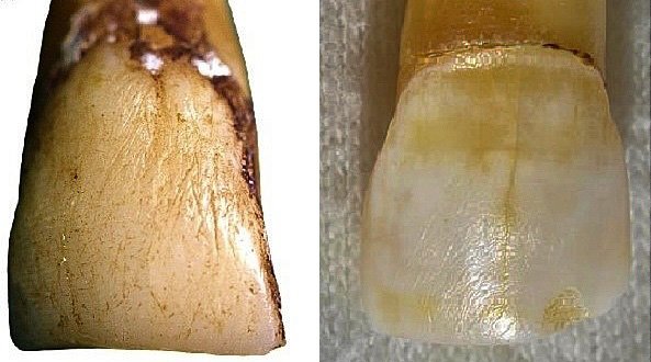 Macroscopic ridges on the outer surface of upper central macaque incisors. PHOTO: SUPPLIED