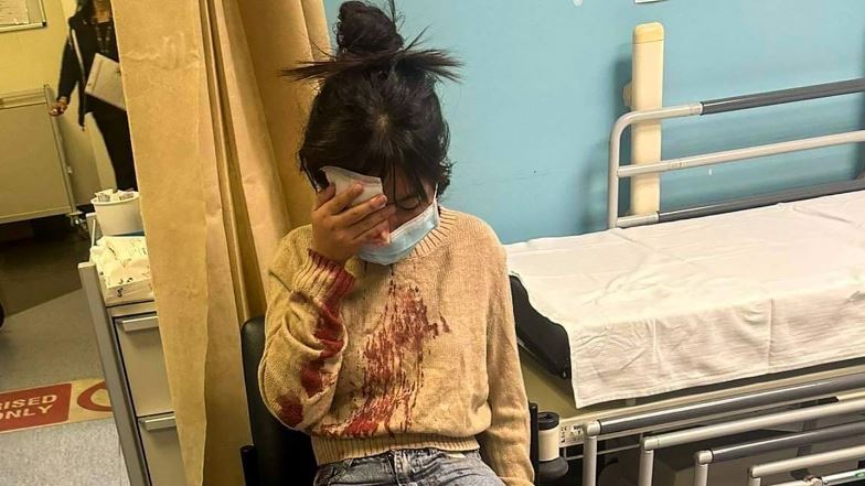 A 12-year-old girl was left covered in blood after being beaten outside McDonald's Glenfield on...