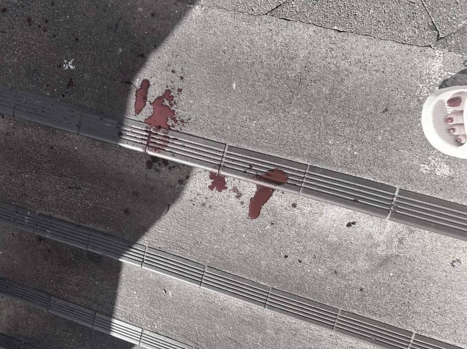 The girl's blood was splattered on the ground after the incident. Photo: supplied