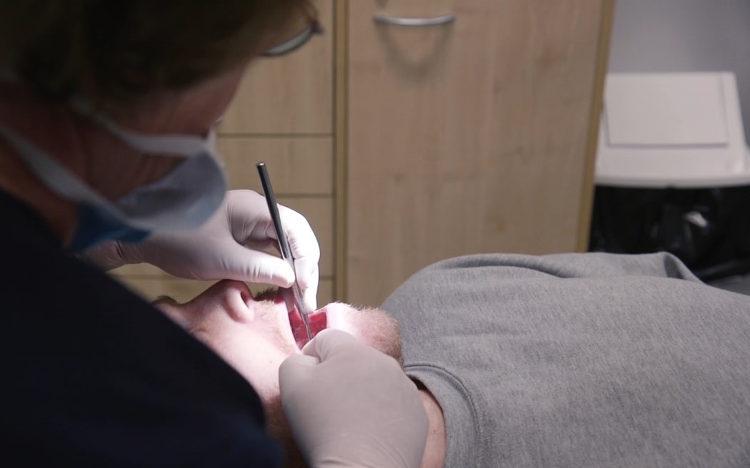 At present, free dental care is only offered to people up to their 18th birthday. Photo: RNZ (file)