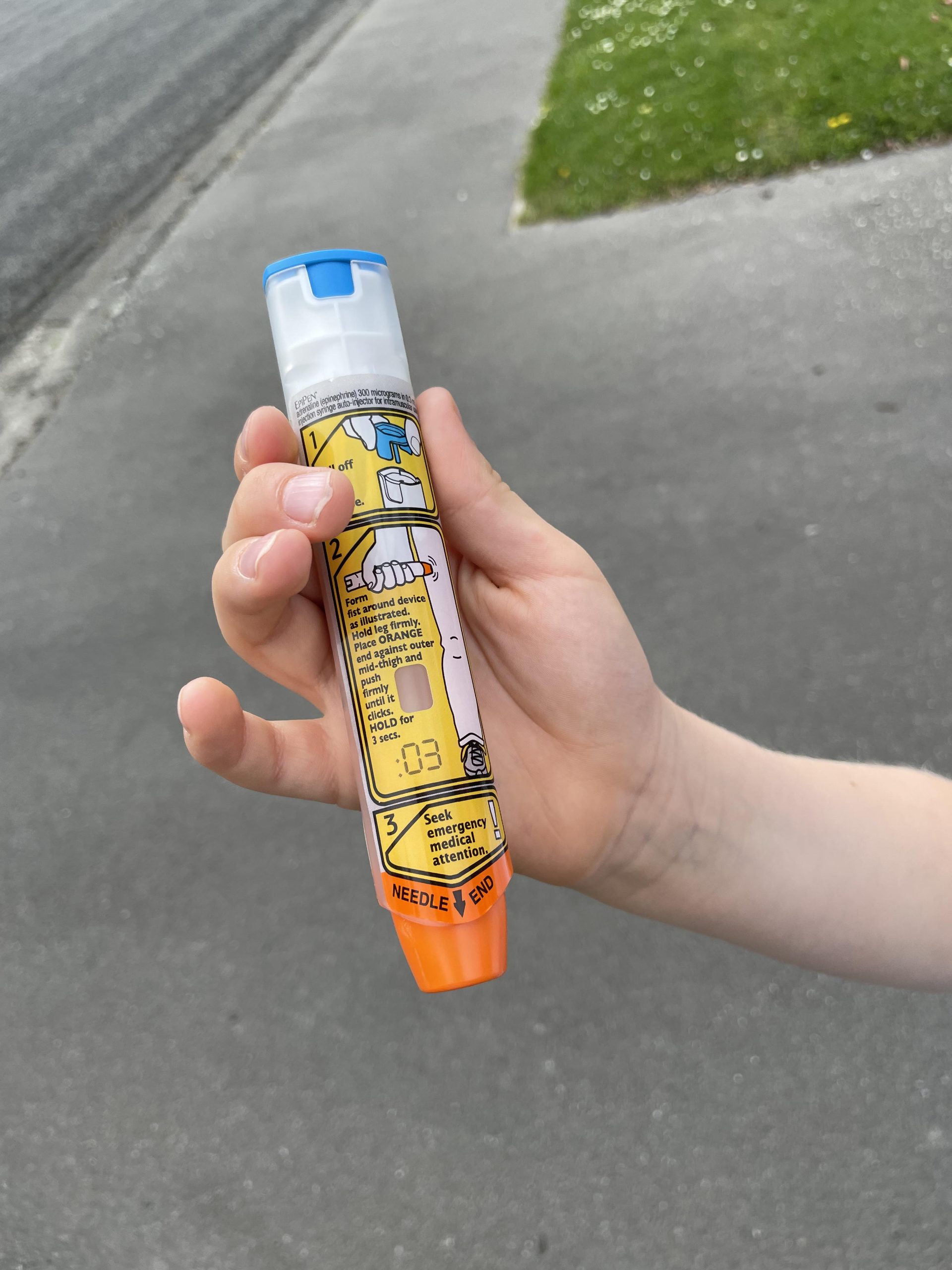 People at risk of anaphylaxis carry Epipens, but will still need to go to hospital for severe...