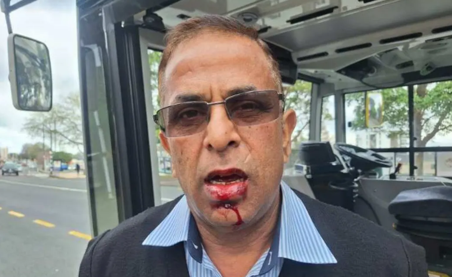 Rajnish Trehan had to receive stitches and will need dental work after being attacked by a...