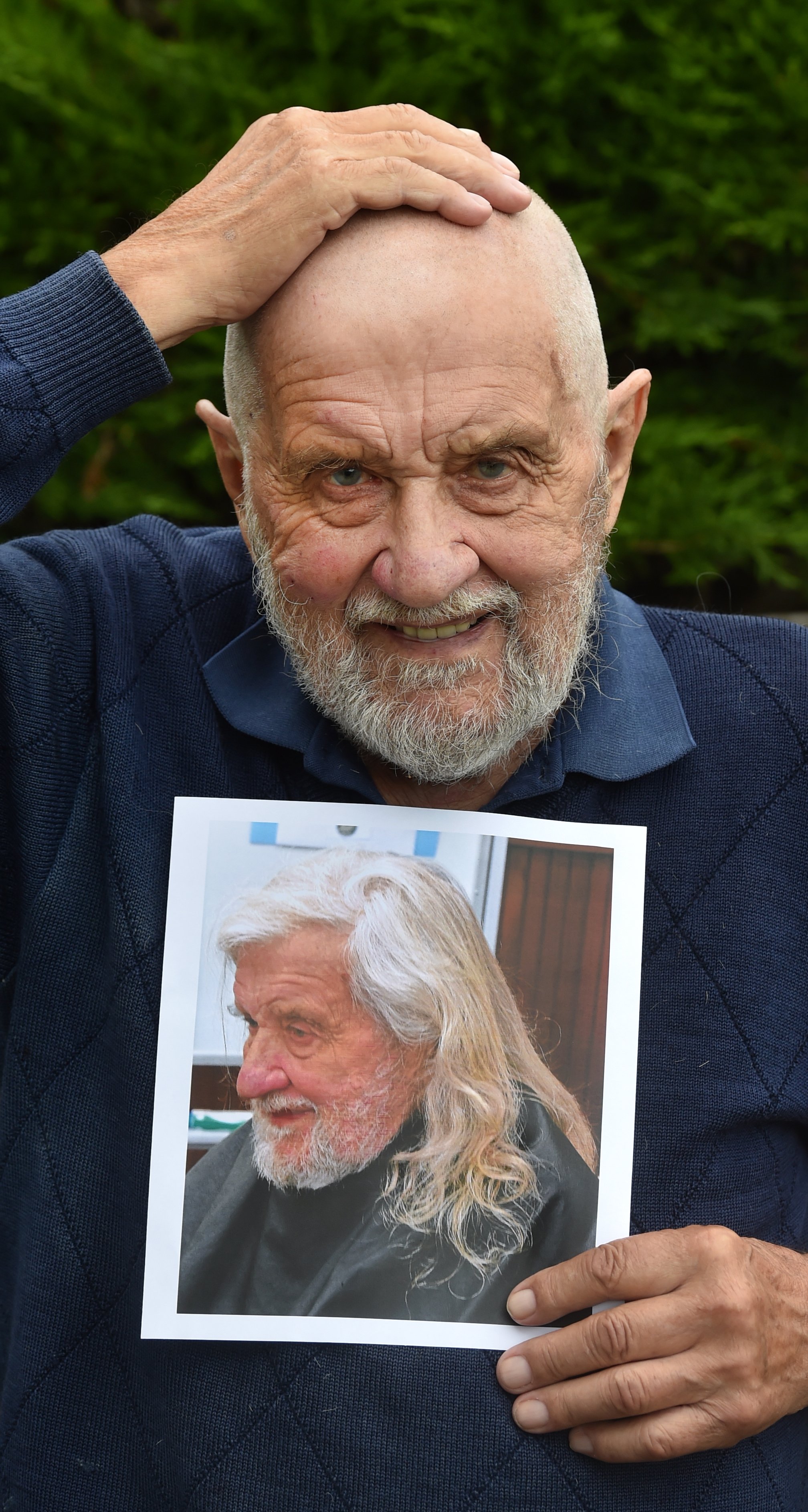 Dunedin man Dai Redshaw holds his bald head while displaying a photo of himself before his big...