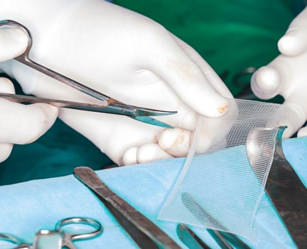 The use of the surgical mesh has cost ACC at least $13 million in injury payouts in the past 12 years. Photo: Getty Images 