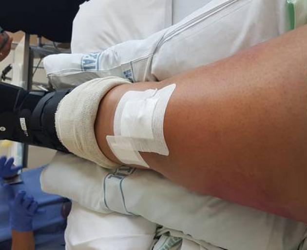 Mum breaks leg soon after birth at hospital | Otago Daily Times Online News