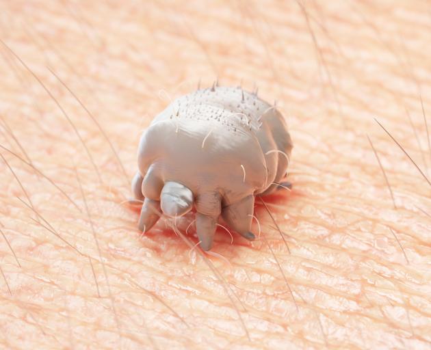 New research shows infestation with the parasitic scabies mite is linked with developing...