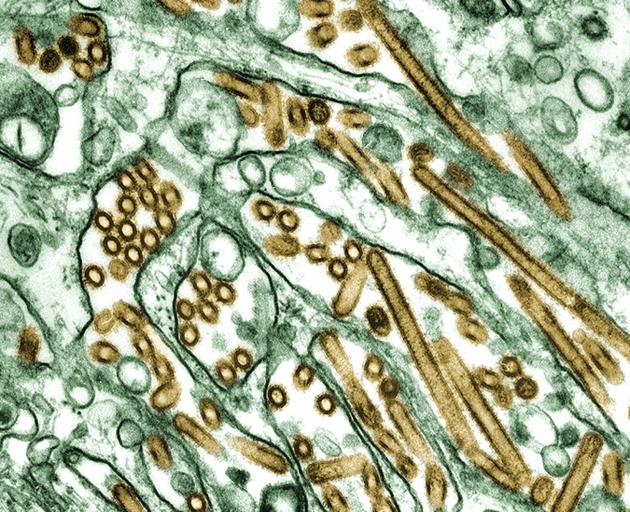 This photograph from a colorized transmission electron micrograph of Avian influenza A H5N1...