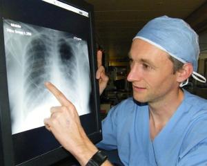 Dunedin Hospital ICU consultant Dr Matthew Bailey examines an X-ray of the air-starved lungs of a...