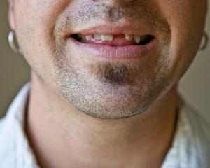 People reported that their oral health was causing them psychological and physical pain and...