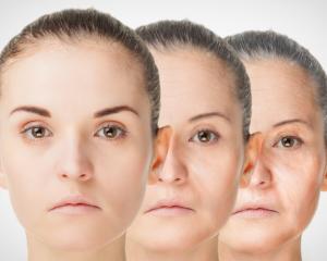 Smoothing out a furrowed brow. Photo: Getty Images