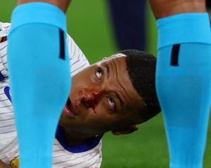 Kylian Mbappe reacts after sustaining his nose injury. Photo: Reuters