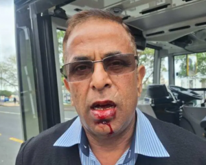 Rajnish Trehan had to receive stitches and will need dental work after being attacked by a...