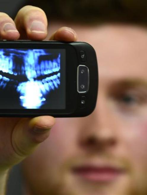 A Dunedin man shows an X-ray image of his jaws, the lower of which was fractured in two places by...