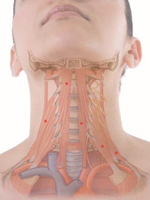 neck diagrams.