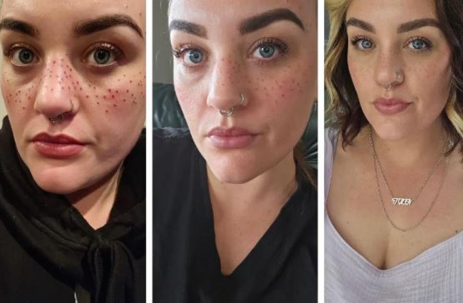 Alex Borrett has nothing bad to say about her freckle tattoos. Photo: Supplied